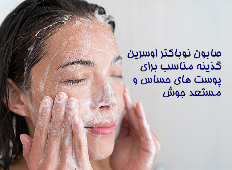 صابون نوباکتر اوسرین مناسب پوست‌های حساس و مستعد جوش
