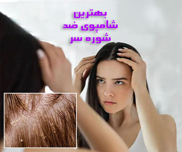 بهترین شامپو ضد شوره : شامپوی مناسب کنترل شوره سر